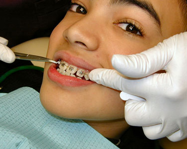 Kids Sarasota and Bradenton: Orthodontists - Fun 4 Sarasota Kids
